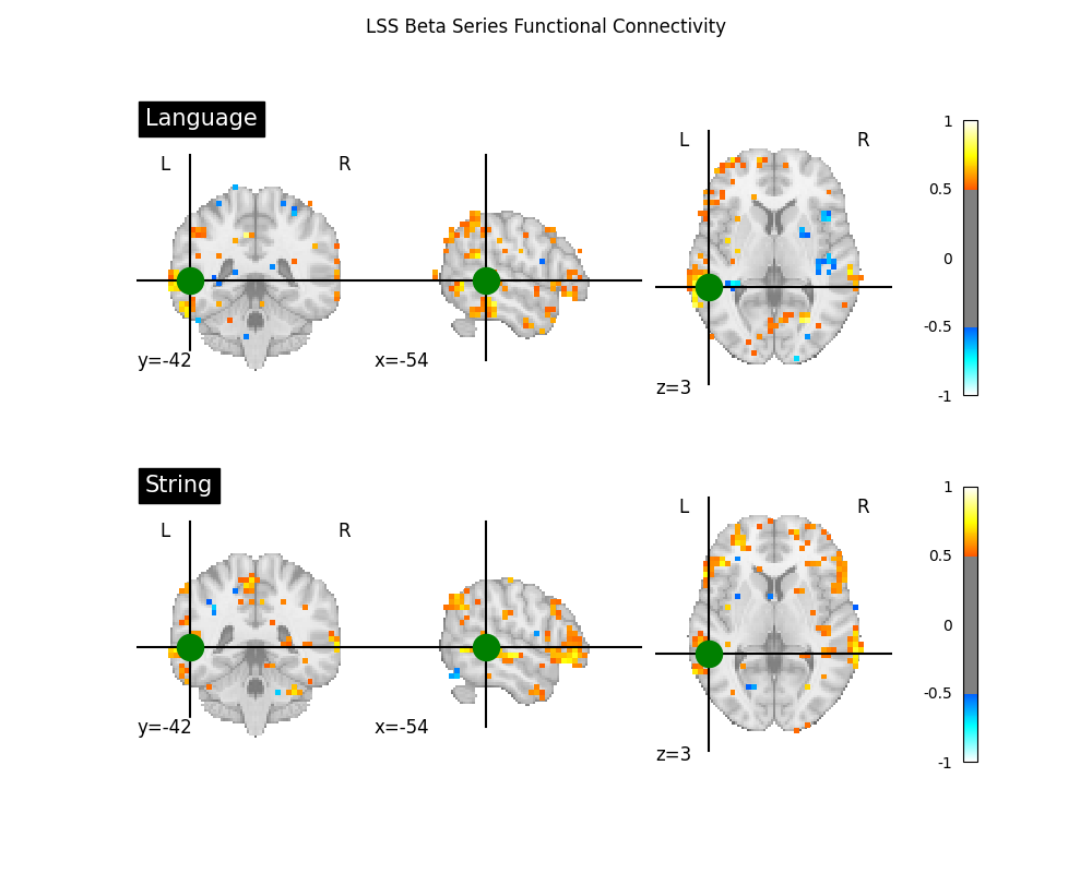 LSS Beta Series Functional Connectivity