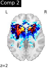 plot compare decomposition