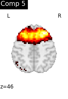 plot compare decomposition