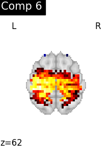 plot compare decomposition