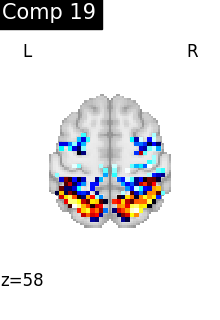 plot compare decomposition