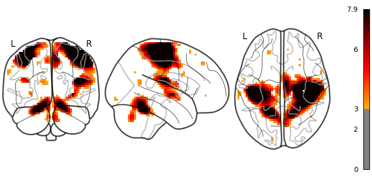 plot demo glass brain extensive