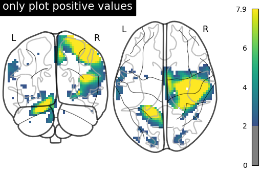 plot demo glass brain extensive