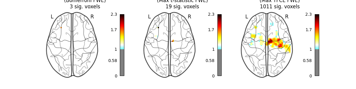 Group left button press ($-\log_{10}$ p-values), Parametric Test (Bonferroni FWE) 3 sig. voxels, Permutation Test (Max t-statistic FWE) 19 sig. voxels, Permutation Test (Max TFCE FWE) 1011 sig. voxels