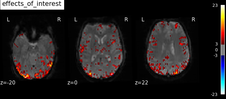 plot spm multimodal faces