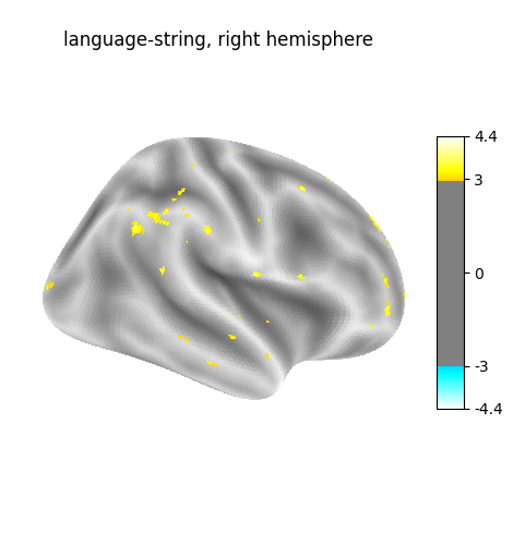 language-string, right hemisphere
